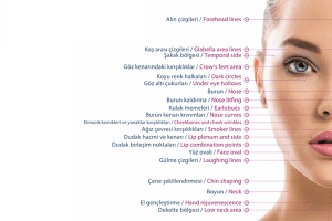Dolgu Uygulamaları